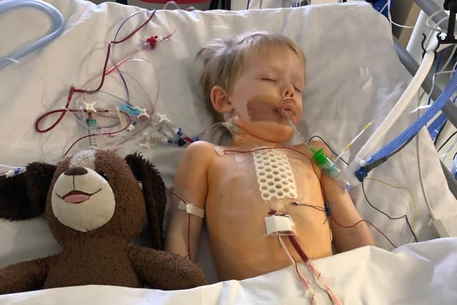 Elijah O'Connell, three, pictured after his open heart surgery at the congenital heart unit at Leeds Children's Hospital in June 2020.