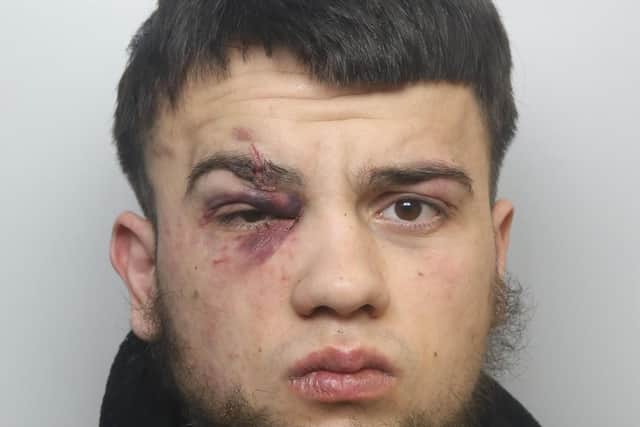 Egzon Miftari was jailed for three and a half years for attacking his partner at her home in Seacroft.