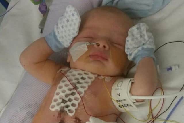 Little Miles when he was a ten week old baby after his open heart surgery at the congenital heart unit in Leeds.