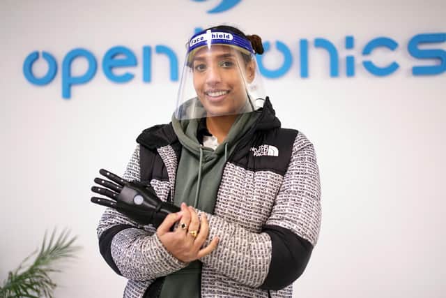 An inspirational Leeds woman who was bullied at school for having one hand is now the proud owner of a £10,000 bionic arm - which makes her feel like a Marvel superhero.
cc Open Bionics