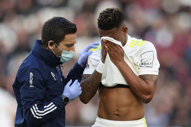 Junior Firpo receives medical attention during Leeds United's 2-0 FA Cup defeat to West Ham United. Pic: Alex Pantling.