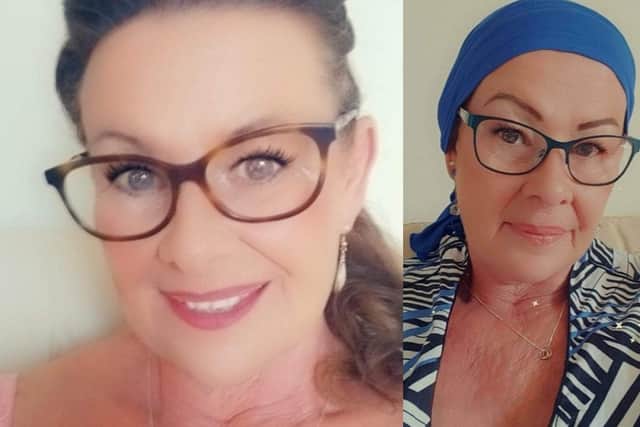 Janet attended a GP appointment in June 2020 after finding a lump about the size of a sprout in her right armpit.