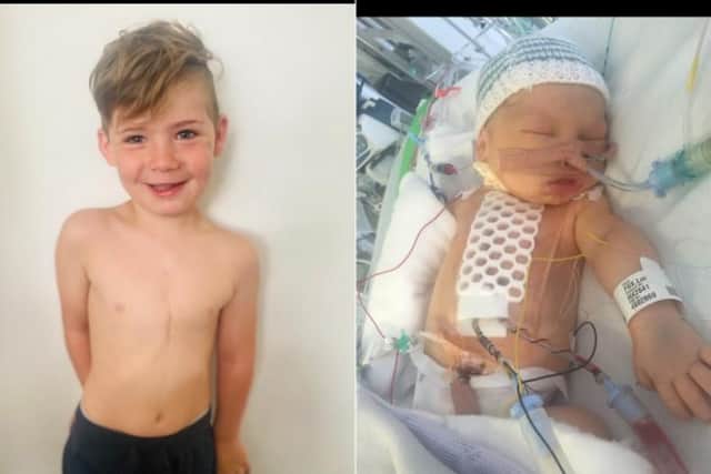 Five-year-old Luca Fox has had eight heart surgeries so far