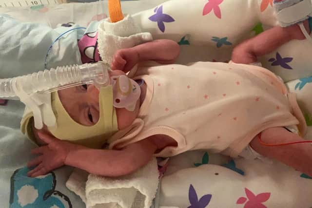Baby Niamh was born at just over 24 weeks in November and is still being cared for in hospital. Picture: SWNS