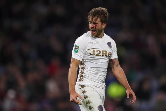 Gaetano Berardi plays on with a blooded face during Leeds United's Carabao Cup clash against Burnley in September 2017. Pic: Robbie Jay Barratt.