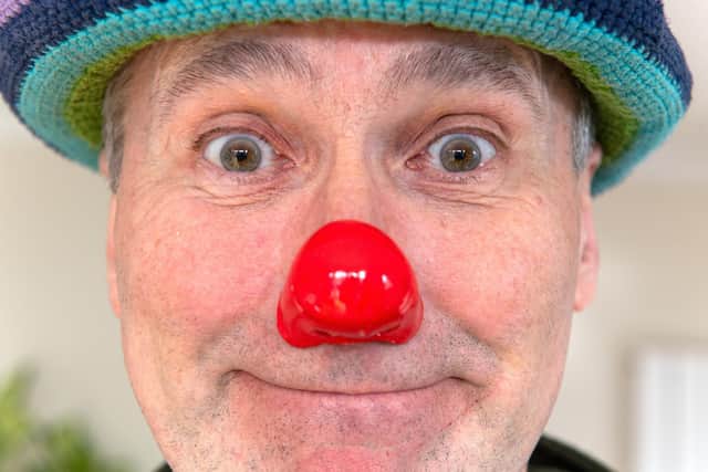 For Pete, the diagnosis came after a career in the circus industry as a professional clown.