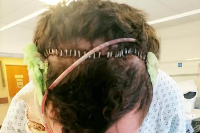 Jon James in Leeds General Infirmary.