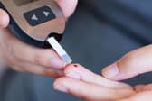 Professor Radford added: “The results are also hugely exciting as they open the door to using the same type of approaches to understanding other amyloid diseases, the vast majority of which currently lack any treatments.” 
cc Adobe/University of Leeds