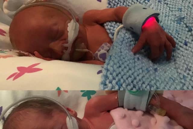 Elijah and Zendaya, were born nine weeks premature following an emergency C-Section.