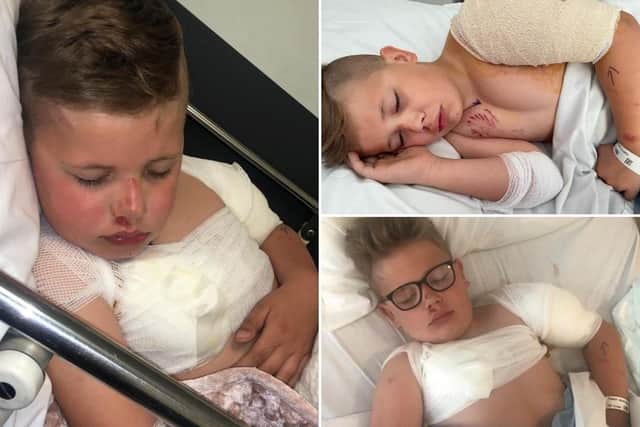 Freddie Turner, seven, needed surgery after being attacked by a dog.