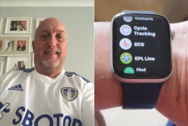Gary Hanson, 60, believed he had atrial fibrillation (AF) – a dangerous heart rhythm condition and a major cause of stroke – for at least two years, jokingly putting his anxiety and irregular heart rhythms down to supporting Leeds United.