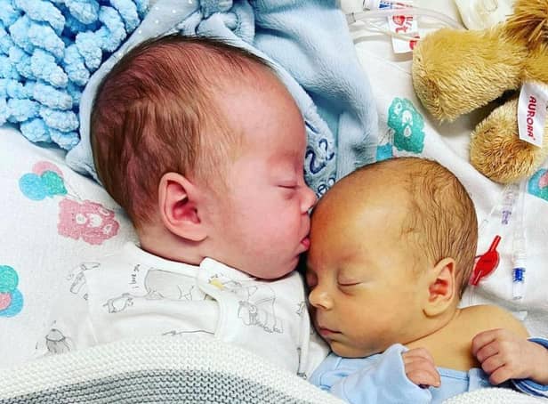 Leo and Luca Hallums were born at just 29 weeks due to complications caused by twin anemia polycythemia sequence (TAPS).