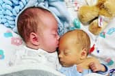Leo and Luca Hallums were born at just 29 weeks due to complications caused by twin anemia polycythemia sequence (TAPS).