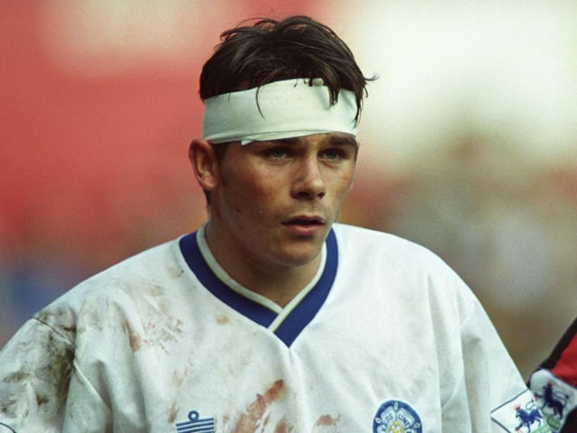 Jamie Forrester needed several stitches after suffering a gashed forehead.