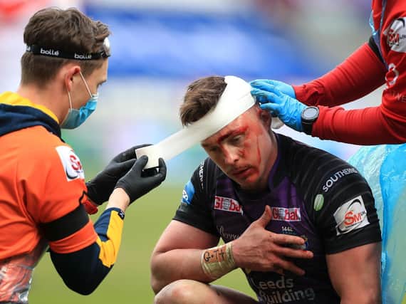 James Donaldson is patched up during the Cup defeat. Picture by Mike Egerton/PA.