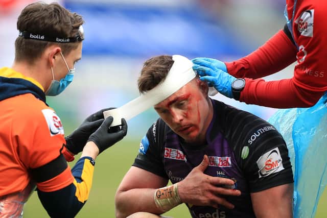 HARD KNOCKS: Leeds Rhinos' James Donaldson receives treatment for a head injury against St Helens. Picture: Mike Egerton/PA Wire.