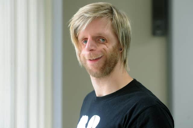 Jono Lancaster who has Treacher Collins Syndrome. Picture: Tony Johnson