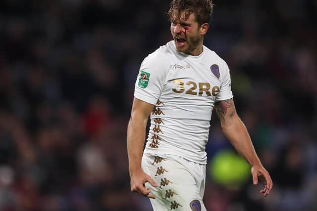 Gaetano Berardi with a bloody face during the Carabao Cup third round clash against Burnley at Turf Moor in September 2017. PIC: Getty