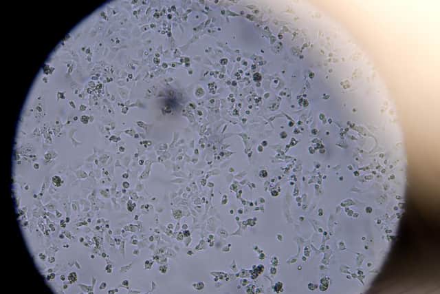 More than 700 patients are thought to have come down with the virus after being admitted to the three hospitals.