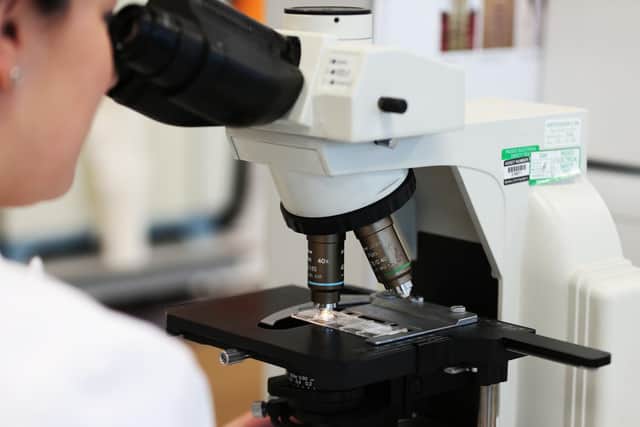 Lab tests and research at the University of Leeds have led to a cancer treatment breakthrough.
