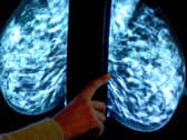 The latest available NHS Digital figures show that 74 per cent of eligible women in Leeds were up to date with their screenings at the end of March 2020 – meaning roughly 19,924 were not.