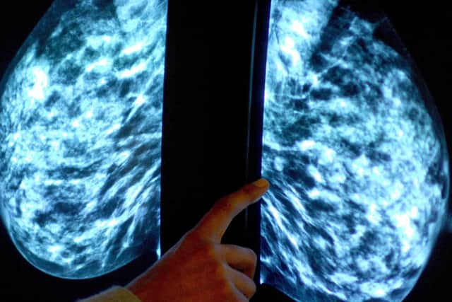 The NHS routinely invites women between the ages of 50 to 70 years old every 3 years. Photo: PA/Rui Vieira