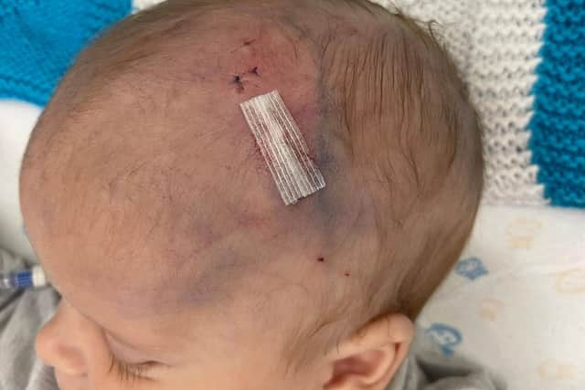 Carson Murgatroyd pictured during treatment in hospital