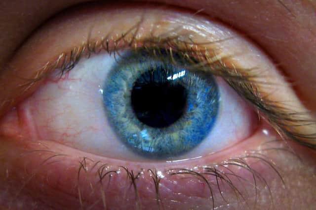 CUES - which stands for COVID-19 Urgent Eyecare Service – is free for all, including children. Picture: PA