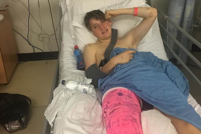 Nicky Newbon pictured in hospital after he was struick by a lorry