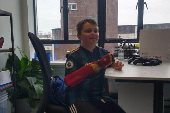 Billy being fitted with his Hero Arm
cc Donna Gregson