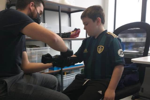 Billy being fitted with his Hero Arm
cc Donna Gregson