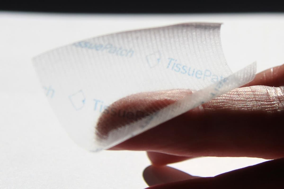 Tissuemend Leeds based medical device manufacturer Tissuemed is acquired by US ...