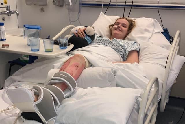 Lucie Maguire recovering in Leeds General Infirmary