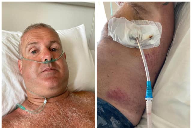 Mark Jepson suffered a punctured lung and broken ribs in the motorbike crash.