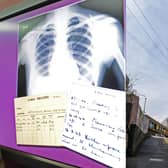 A six-month project was launched in Armley to help people get treatment for TB (Stock photo by National World)