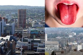 Here is the location of every case of scarlet fever recorded in Yorkshire in the week to December 4, the latest available Government figures.