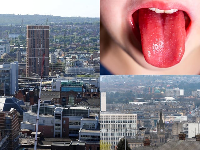 Here is the location of every case of scarlet fever recorded in Yorkshire in the week to December 4, the latest available Government figures.