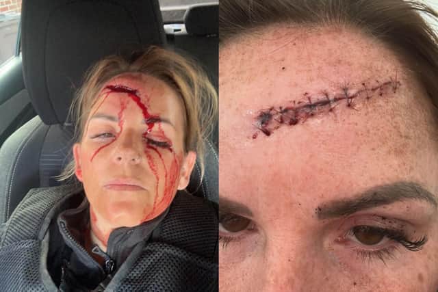 PC Sam Woods, who works on the city’s drugs team, was left with a large gash on her forehead following the attack last month (Photo by PC Woods)