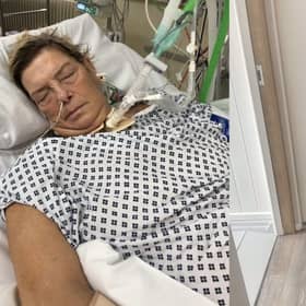Kim, 61, developed sepsis in 2017 and had her hands and legs amputated in 2018.