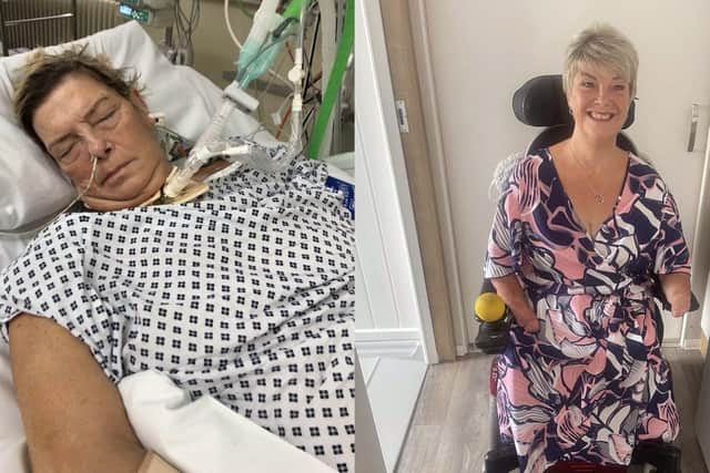 Kim, 61, developed sepsis in 2017 and had her hands and legs amputated in 2018.