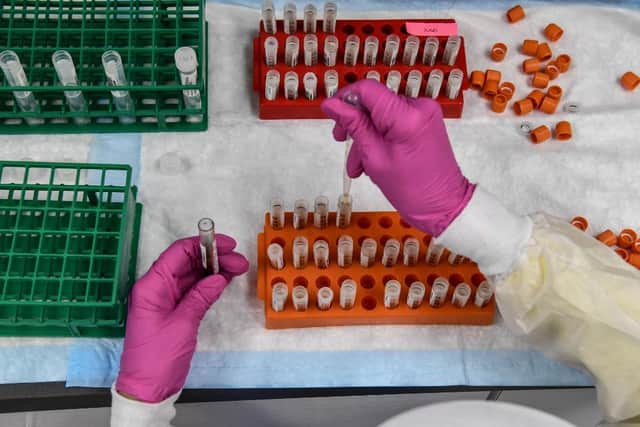 The Pfizer, Oxford and Moderna vaccines all differ (Getty Images)
