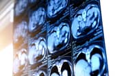 The scans will be provided alongside lung health checks as part of a new National Lung Screening Programme