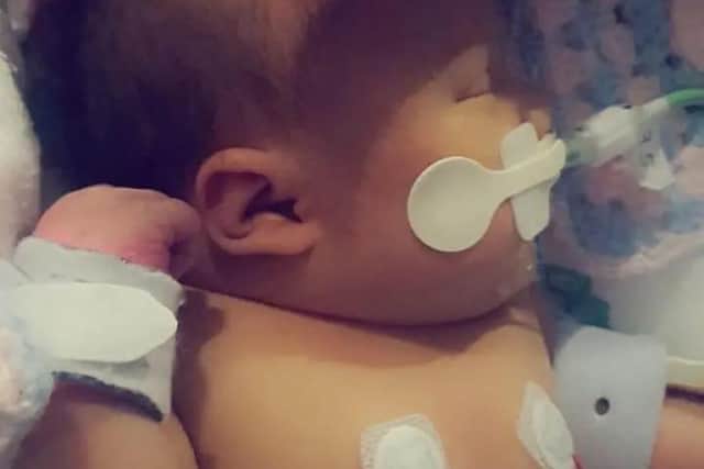 Ava Kirkby was born in February 2019 with critical Pulmonary Stenosis.