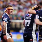 Leeds Rhinos'Danny Levi shows the scars of battle during last weekend's win agianst Hull KR Picture by Alex Whitehead/SWpix.com.