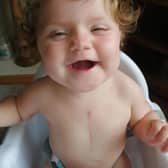 Ava Kirkby was born in February 2019 with critical Pulmonary Stenosis.