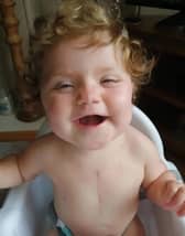 Ava Kirkby was born in February 2019 with critical Pulmonary Stenosis.