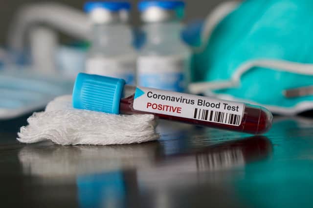 Coronavirus cases in the UK are continuing to rise, but what is the current advice for what to do if you think you have the virus, and can you get tested for it in Leeds?