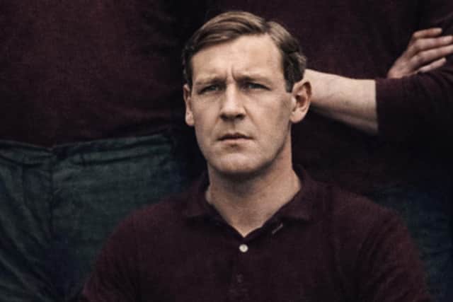 Anthony Sparks, whose leg was amputated. (Image: Steve Hill).