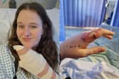 Crystal (left) and her left index finger just before her surgery.