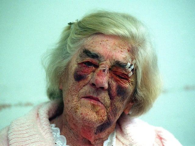 This is 81-year-old Mary Hansborough who was recovering after being attacked at her home in Gipton in September 1999.